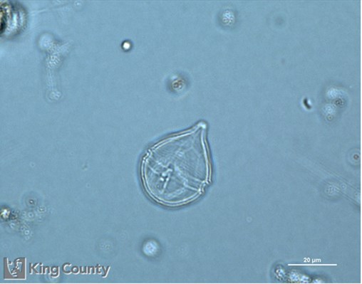 Photo of Scrippsiella trochoidea